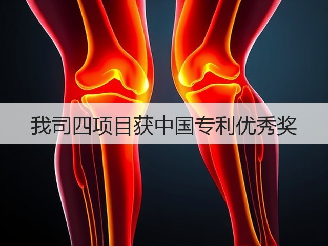 我司四项目获中国专利优秀奖